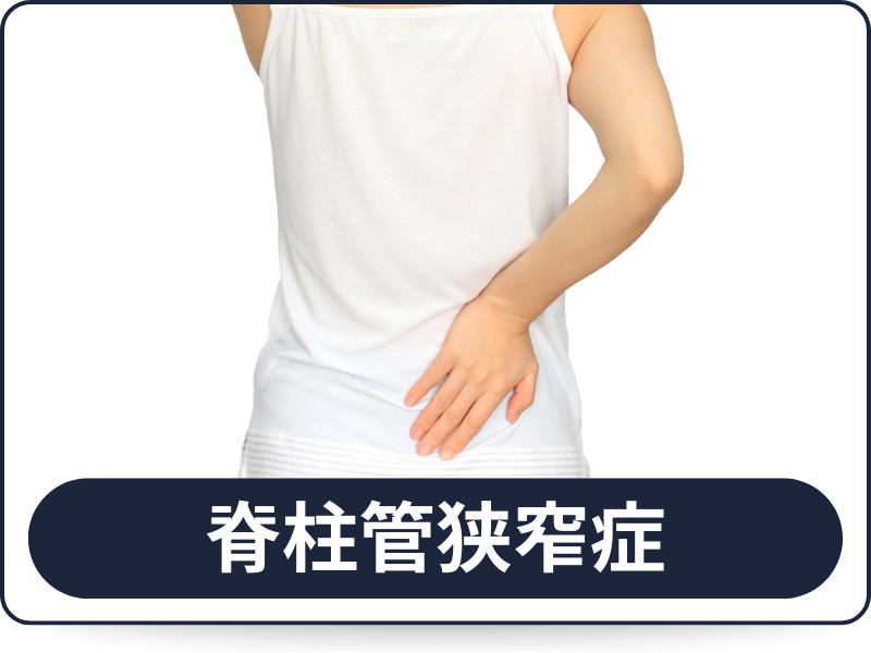 脊柱管狭窄症