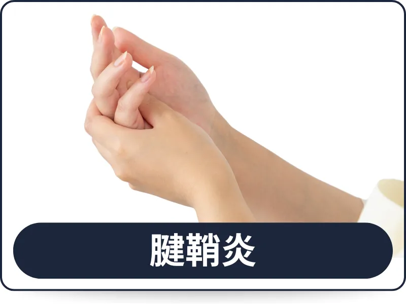 六本木の整体サロン「モビリティ整体ソシオ」で対応している腱鞘炎の症状イメージ。手首の痛みや指の動かしづらさで悩む方に向けた施術バナー。