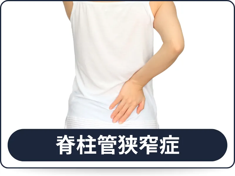 六本木で脊柱管狭窄症による歩行や足のしびれに悩む方へ