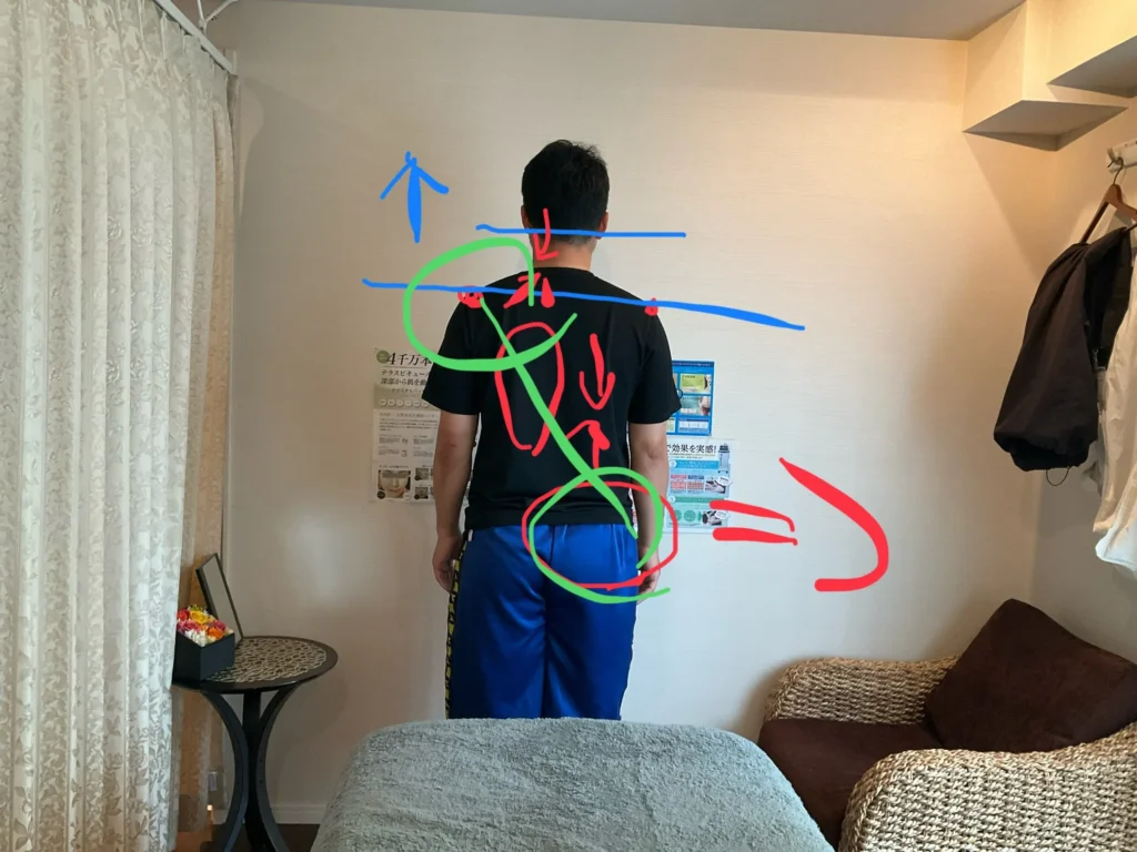 六本木の整体 モビリティ整体ソシオで姿勢チェックを行い、肩・骨盤・重心の左右差を確認している様子