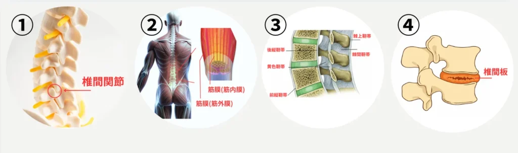 六本木の整体モビリティ整体ソシオ｜ぎっくり腰（急性腰痛）の代表的なタイプ（椎間関節・筋膜・靭帯・椎間板）の解説図