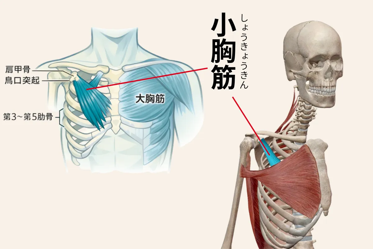 小胸筋と首まわりの筋肉が肩甲骨の位置に与える影響を示したイラスト